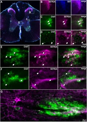 Somatostatin 2 Receptors in the Spinal Cord Tonically Restrain Thermogenic, Cardiac and Other Sympathetic Outflows